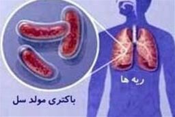 تشخیص بیماری سل در کمتر از ۱۰۰ دقیقه در ایران امکانپذیر شد