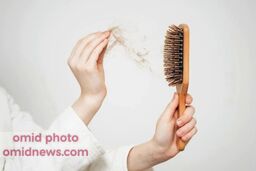 خوراکی هایی که باعث ریزش مو می شوند