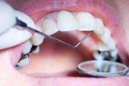 مشکلات و خبرهای خوش دندانپزشکی از زبان وزیر بهداشت