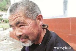 مردی که در گردنش شاخ دارد! + عکس