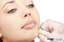اگر قصد دارید تزریق ژل لب کنید حتما این مقاله را بخوانید