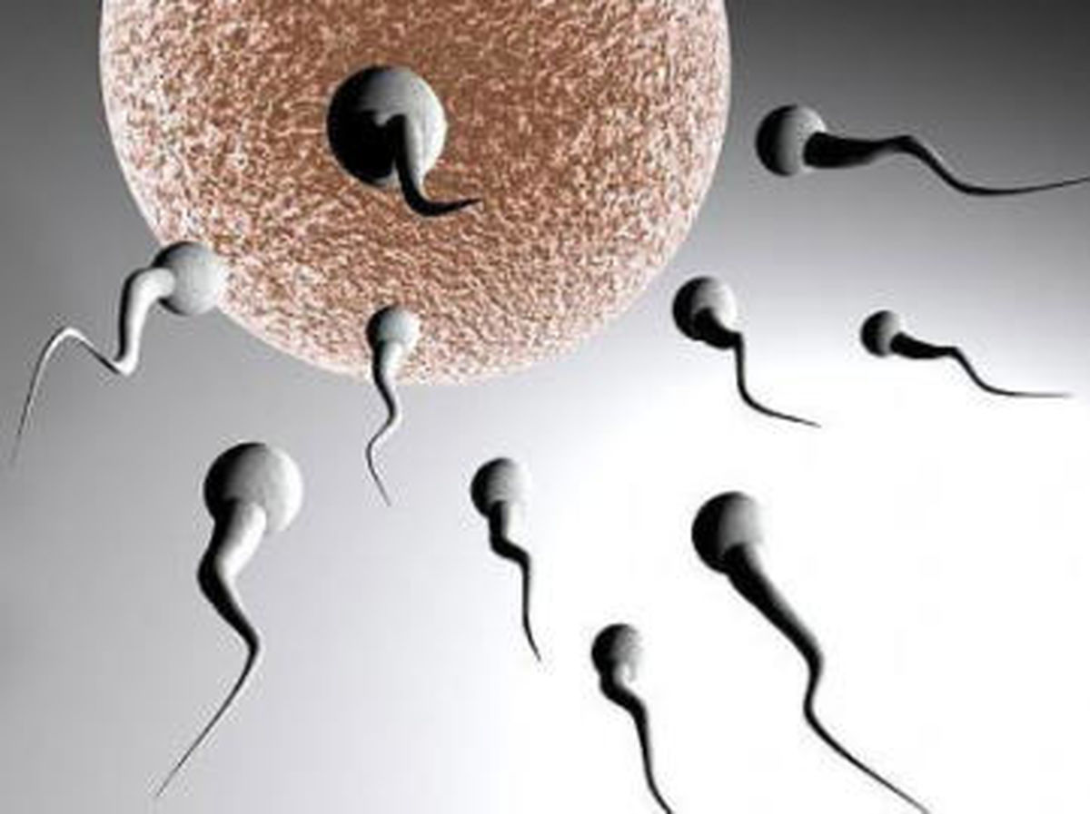 بانک اسپرم به درد چه کسانی می خورد؟